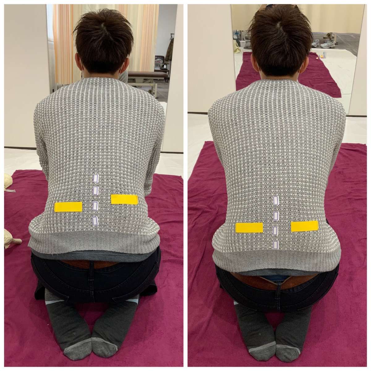 足の裏の痛み 体の歪みを整えることで改善