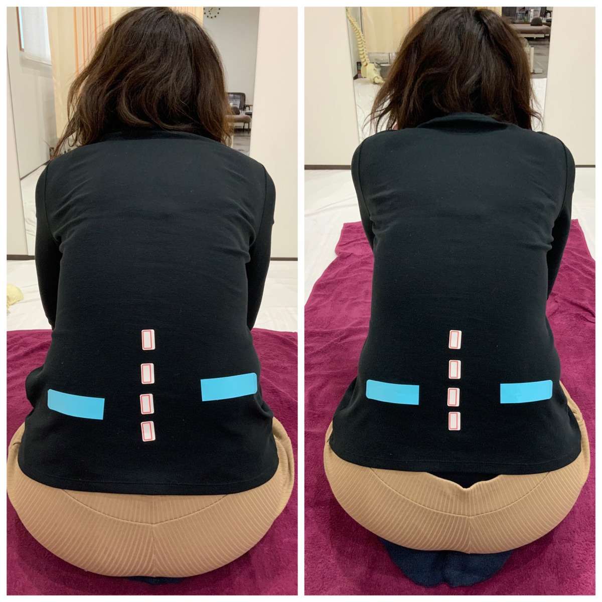 腰痛、肩こり 体の歪みを整える事で改善