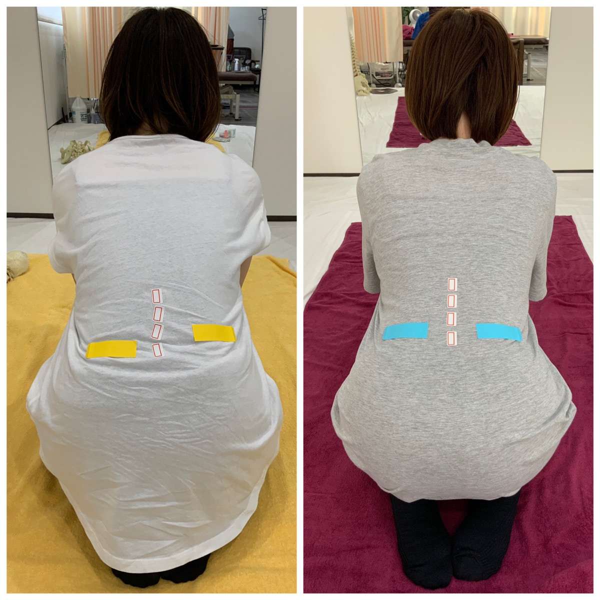 産後全身調整 10回施術後の変化