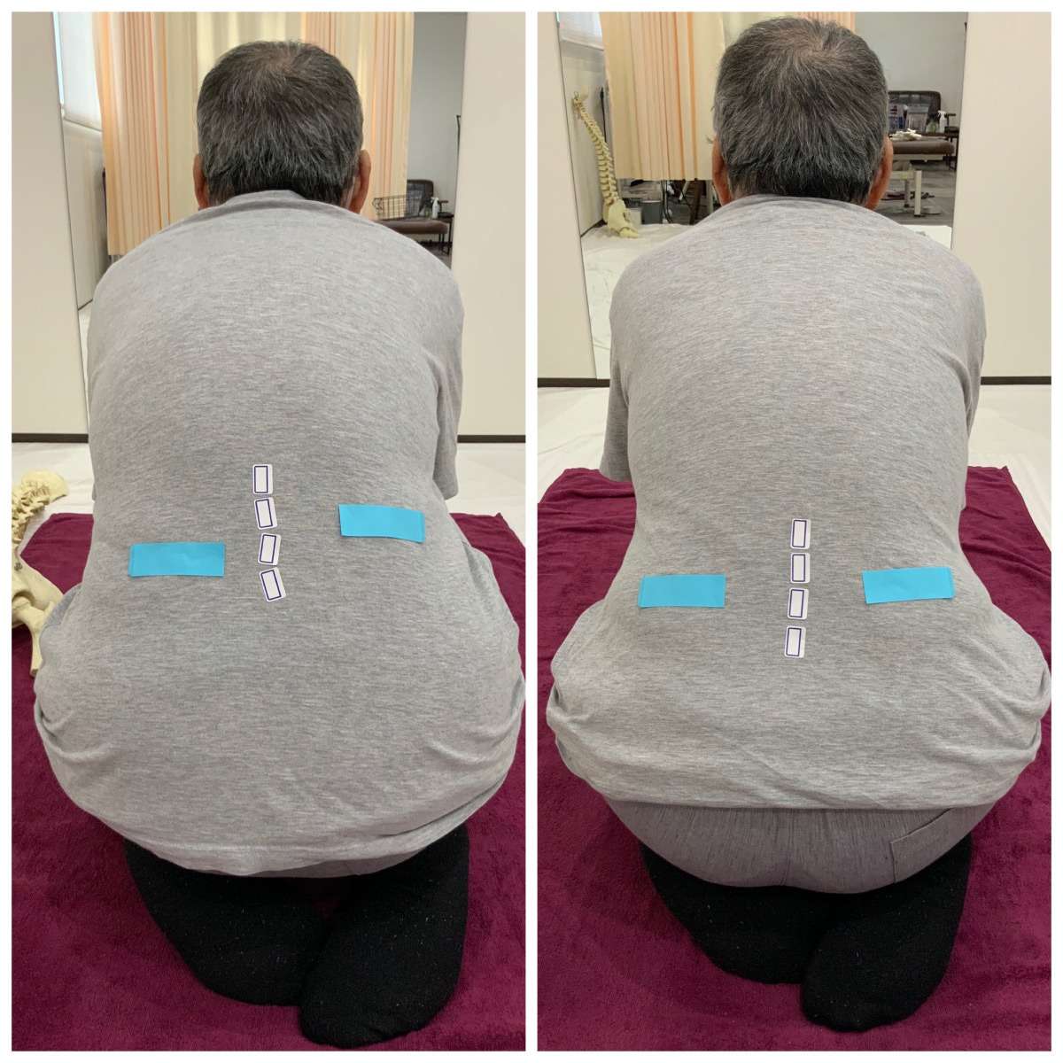 自律神経失調症 体の歪みを整えることで改善